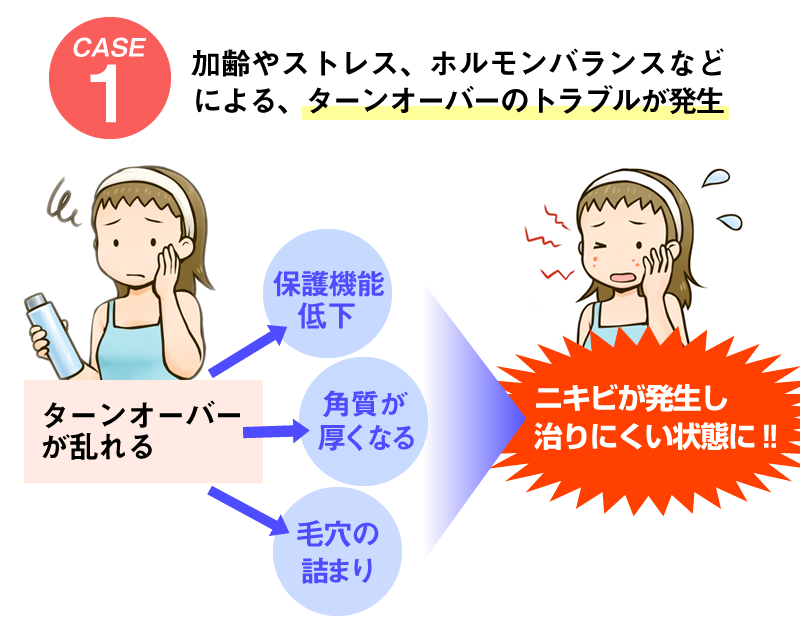 ケース1 加齢やストレス、ホルモンバランスなどによる、ターンオーバーのトラブルが発生