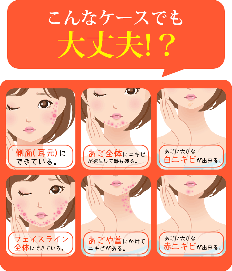 こんなケースでも大丈夫!？